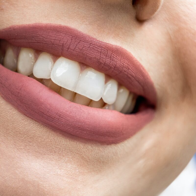 a close up of a woman's mouth with white teeth